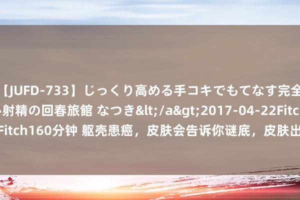 【JUFD-733】じっくり高める手コキでもてなす完全勃起ともの凄い射精の回春旅館 なつき</a>2017-04-22Fitch&$Fitch160分钟 躯壳患癌，皮肤会告诉你谜底，皮肤出现这3种很是，尽早作念查验